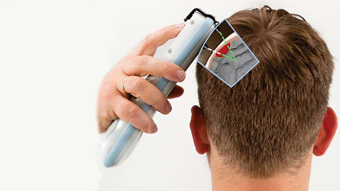 Infrascanner